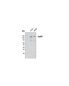 Cell Signaling EphB1 (5F10) Mouse mAb 20 uL