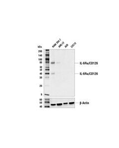 Cell Signaling IL-6Ralpha/CD126 (E7H4J) Rabbit mAb 20 uL