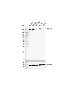 Cell Signaling Col1a1 (E6a8e) Rabbit mAb