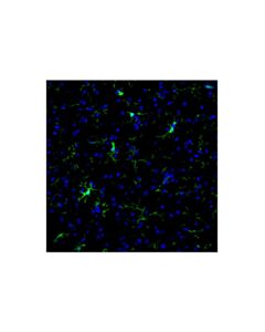 Cell Signaling ASC/TMS1 (D2W8U) Mouse Chimeric mAb