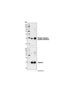 Cell Signaling Phospho-Troponin I (Cardiac) (Ser23/24) Antibody
