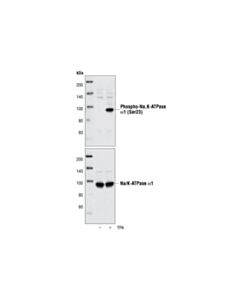 Cell Signaling Phospho-Na,K-Atpase Alpha1 (Ser23) Antibody