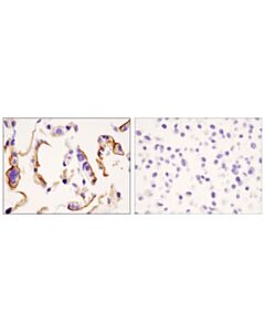 Cell Signaling Dpp4/Cd26 (D6d8k) Rabbit mAb (Ihc Formulated)