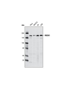 Cell Signaling Rock1 (C8f7) Rabbit mAb