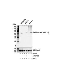 Cell Signaling Phospho-Akt (Ser473) (587f11) Mouse mAb