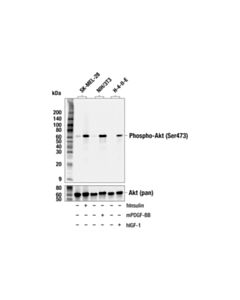 Cell Signaling Phospho-Akt (Ser473) (193h12) Rabbit mAb