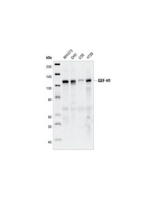 Cell Signaling GEF-H1 (55B6) Rabbit mAb 20 uL