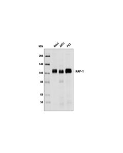 Cell Signaling Tif1beta Antibody