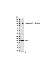 Cell Signaling Phospho-Tif1beta (Ser824) Antibody