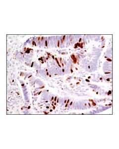 Cell Signaling Phospho-Rb (Ser807/811) (D20b12) Rabbit mAb (BSA And Azide Free)