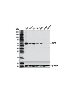 Cell Signaling Rip2 (D10b11) Rabbit mAb