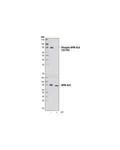 Cell Signaling Phospho-Alk (Tyr1096) Antibody