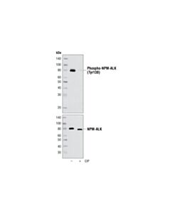 Cell Signaling Phospho-Alk (Tyr1078) Antibody