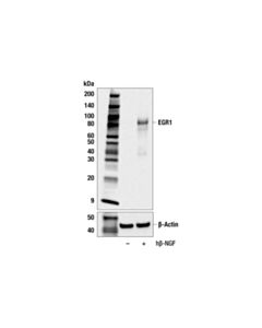 Cell Signaling Egr1 (44d5) Rabbit mAb