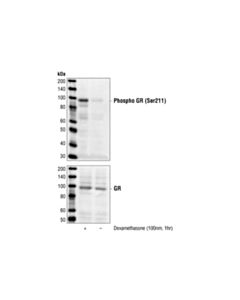 Cell Signaling Phospho-Glucocorticoid Receptor (Ser211) Antibody