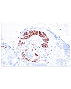 Cell Signaling GAP43 (E6L2W) Mouse mAb 20 uL