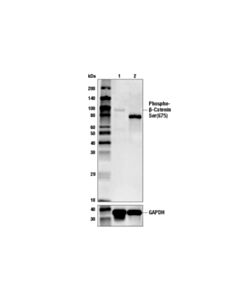 Cell Signaling Phospho-Beta-Catenin (Ser675) (D2f1) Xp Rabbit mAb