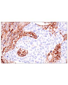 Cell Signaling HLA-B (BC43) Mouse mAb