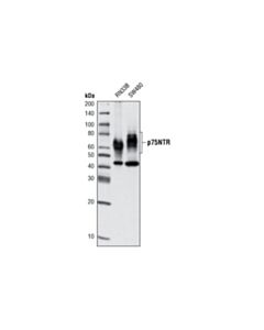 Cell Signaling p75NTR (D8A8) Rabbit mAb 20 uL