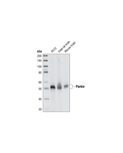 Cell Signaling Parkin (Prk8) Mouse mAb