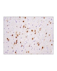Cell Signaling Tbr1 (D6c6x) Rabbit mAb (BSA And Azide Free)