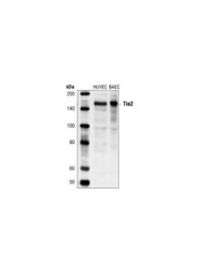 Cell Signaling Tie2 (AB33) Mouse mAb 20 uL