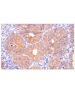 Cell Signaling POFUT1 (E8F4R) Rabbit mAb (IHC Formulated)