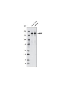 Cell Signaling nNOS (C7D7) Rabbit mAb 20 uL