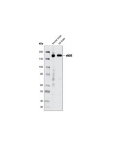 Cell Signaling Nnos (C12h1) Rabbit mAb