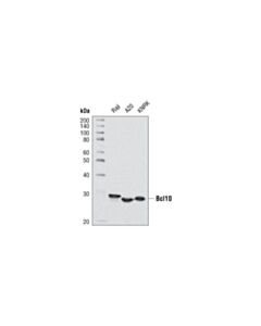 Cell Signaling Bcl10 (C78f1) Rabbit mAb
