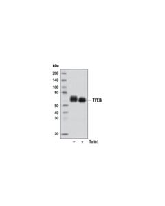 Cell Signaling Tfeb Antibody