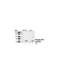 Cell Signaling Phospho-Srf (Ser103) Antibody