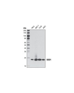 Cell Signaling Sod1 (71g8) Mouse mAb