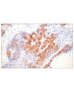 Cell Signaling Egf Receptor (D38b1) Xp Rabbit mAb
