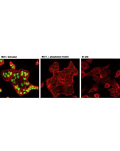 Cell Signaling Phospho-Rb (Ser807/811) (D20b12) Xp Rabbit mAb (Alexa Fluor 488 Conjugate)