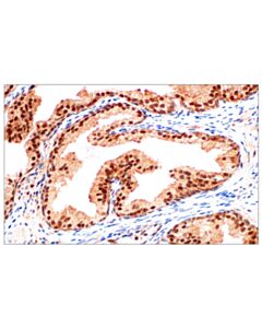 Cell Signaling Angiogenic Switch Antibody Sampler Kit