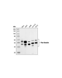 Cell Signaling Pan-Keratin (C11) Mouse mAb (Biotinylated)