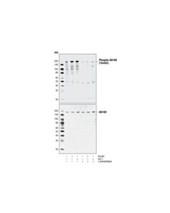 Cell Signaling Phospho-As160 (Thr642) Antibody