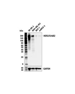 Cell Signaling Her2/Erbb2 (D8f12) Xp Rabbit mAb