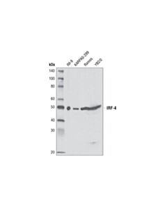 Cell Signaling Irf-4 (D43h10) Rabbit mAb
