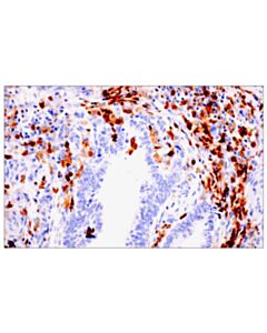 Cell Signaling p47phox (D21F6) Rabbit mAb 20 uL