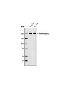 Cell Signaling Tuberin/Tsc2 (D93f12) Xp Rabbit mAb