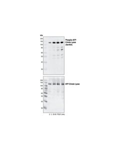 Cell Signaling Phospho-ATP-Citrate Lyase (Ser455) Antibody