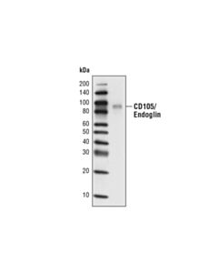 Cell Signaling Cd105/Endoglin (D50g1) Rabbit mAb