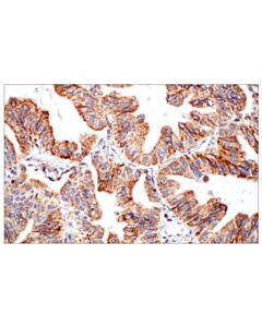 Cell Signaling Dhfr (E6l1h) Rabbit mAb