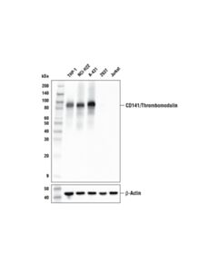Cell Signaling Cd141/Thrombomodulin (E7y9p) Xp Rabbit mAb