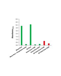 Cell Signaling Pathscan Phospho-Tau (Ser396) Sandwich ELISA Kit