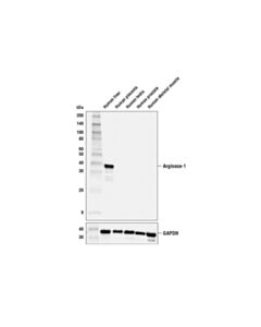 Cell Signaling Arginase-1 (E4U1I) Mouse mAb 20 uL