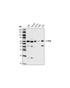 Cell Signaling beta-TrCP (D13F10) Rabbit mAb 20 uL