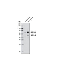 Cell Signaling STEP (23E5) Mouse mAb 20 uL